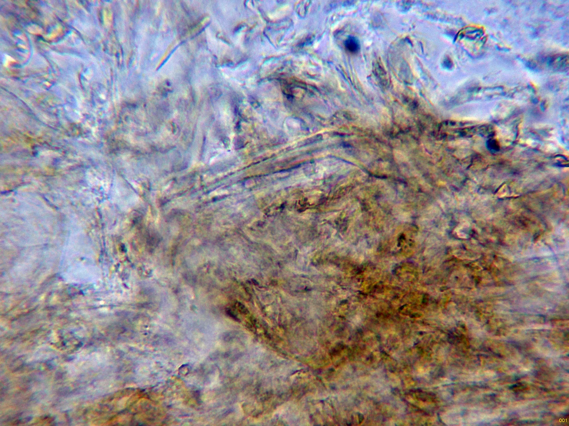 Microscopía de Phlegmacium percome - 10 - Suprapellis agua-001